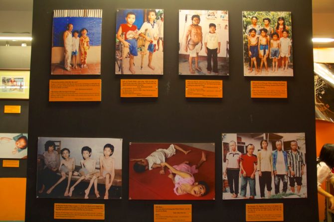 These are children of people impacted by agent orange in the war - not pictures of the war itself.